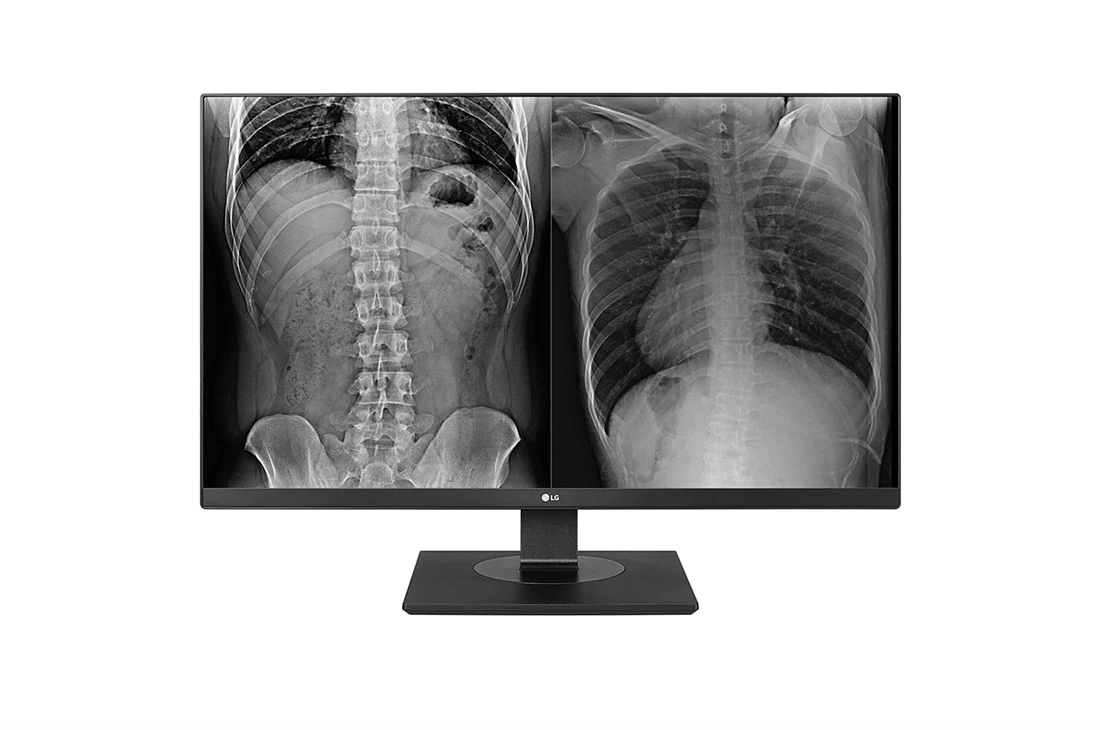 LG 8MP Clinical Review Monitor
